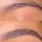 Lifting de cejas